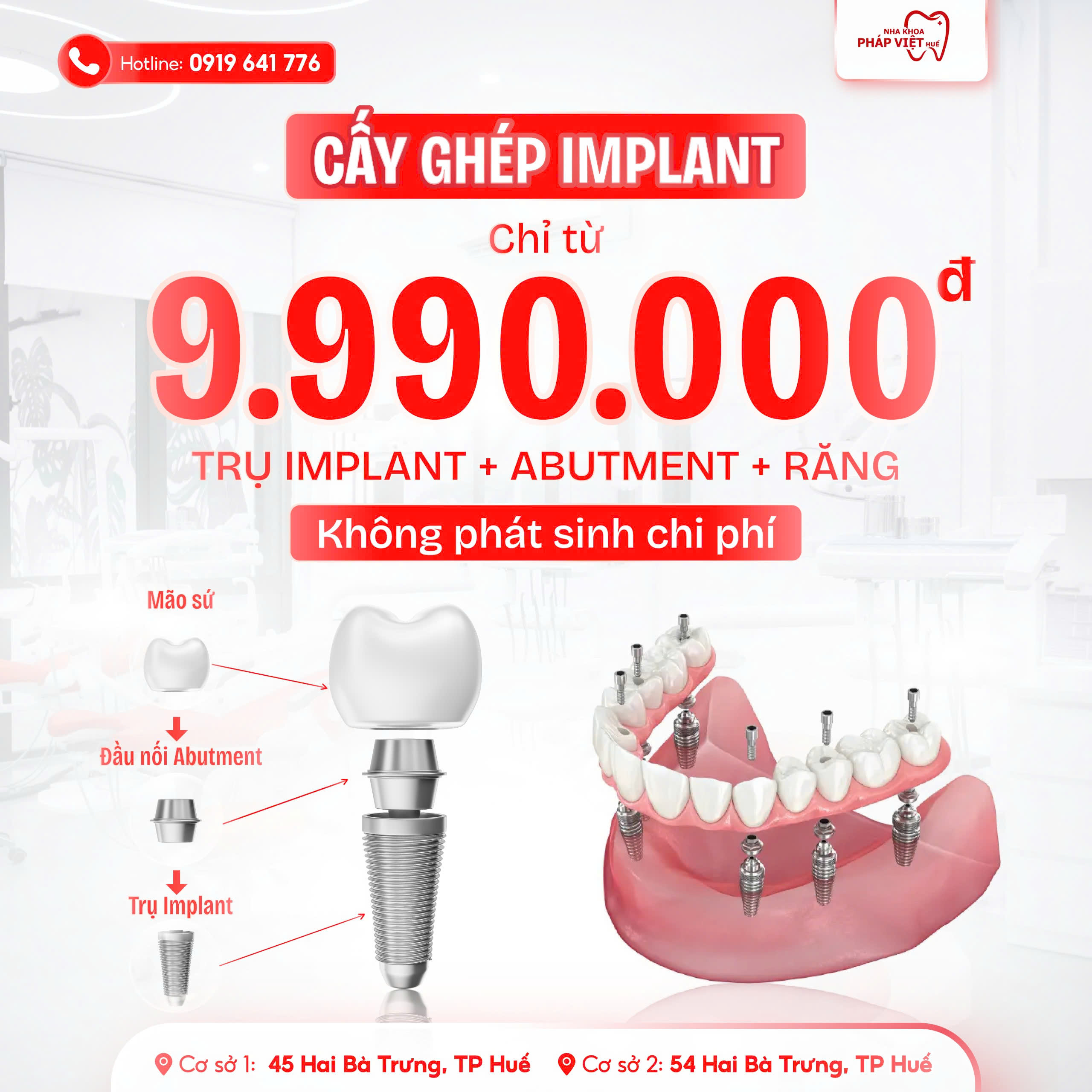 content-qc-implant